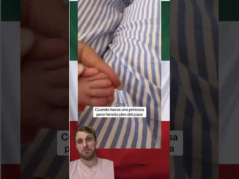 “No puede ser…” 😳 Mamá descubre qué heredó su bebé #reacción