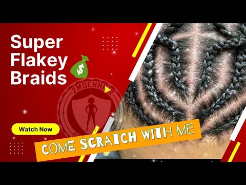 SUPER Flakey Braid removal