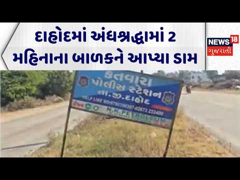 Dahod Superstition | દાહોદમાં અંધશ્રદ્ધામાં 2 મહિનાના બાળકને આપ્યા ડામ | Black Magic | Superstition