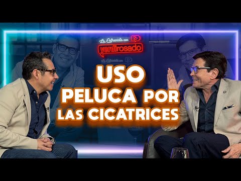 USO PELUCA por las CICATRICES | Juan José Origel | La entrevista con Yordi Rosado