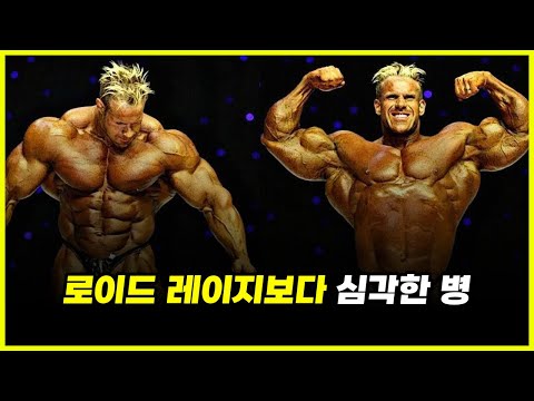 너는 왜 약물도 안 쓰는데 로이드 레이지가 와?