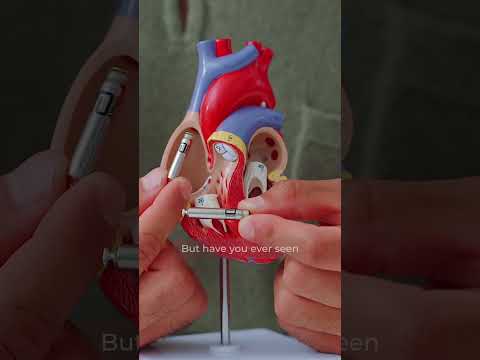World’s first FDA-approved dual-chamber leadless pacemaker system: abbottglobal AVEIR™ DR.