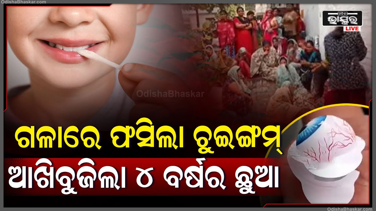 ନିଜ ପିଲାଙ୍କୁ ଚୁଇଙ୍ଗମ୍ ଖାଇବାକୁ ଦେଉଥିଲେ ହୋଇଯାଆନ୍ତୁ ସାବଧାନ୍ ! ନହେଲେ ଆପଣଙ୍କ ପିଲାଙ୍କ ସହ ବି ହୋଇପାରେ ଏମିତି