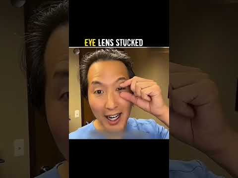 If Eye Lens Got Stucked ! #Fertile Facts