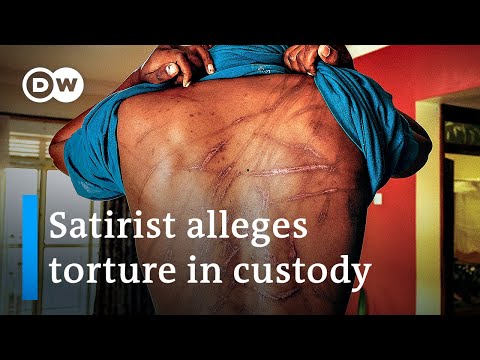 Uganda's government accused of human rights abuses, torture | DW News