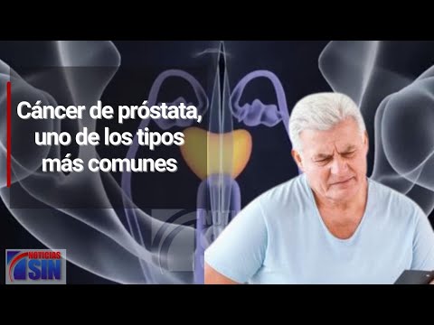 Cáncer de próstata, uno de los tipos más comunes