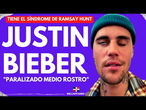 Justin Bieber tiene parálisis facial por síndrome de Ramsay Hunt