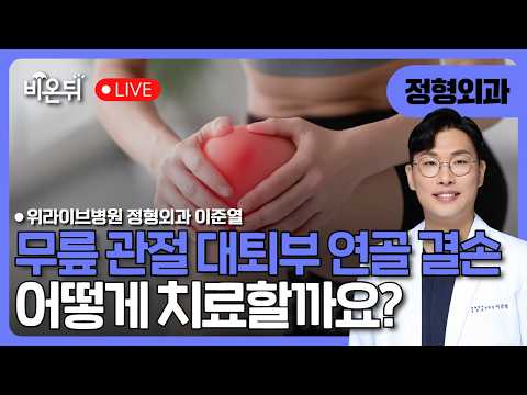 무릎관절 대퇴부 연골결손 <strong>치료</strong> / 위라이브병원 정형외과 이준열