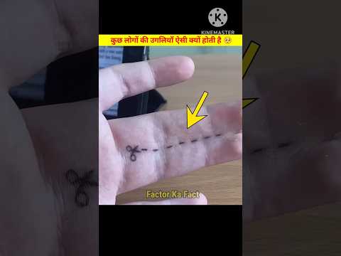 कुछ लोगों की उंगलियाँ ऐसी क्यों होती है🥺 #ytshorts #shortsfeed #viral #shorts #facts