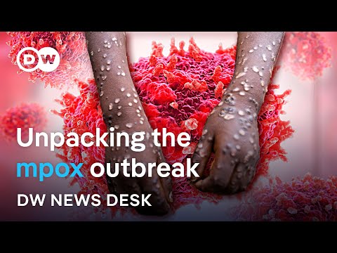 How dangerous is the mpox clade Ib public health emergency? | News Desk