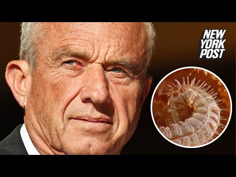 RFK Jr. said doctors found a dead worm in his head after it ate part of his brain