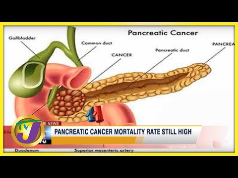 Pancreatic Cancer Mortality rate Still High in Jamaica | TVJ News - Nov 17 2021