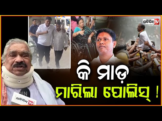 କି ମାଡ଼, ବବି ପଡ଼ିଛି ଆପୋଲୋରେ, ଡାନି ଉତ୍କଳ ହସ୍ପିଟାଲ ରେ ! BJD workers injured & admitted in Hospital.