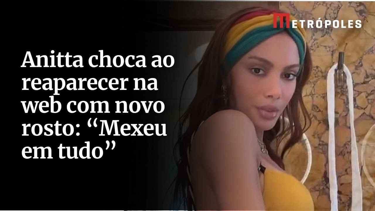 Anitta choca ao reaparecer na web com novo rosto: “Mexeu em tudo”