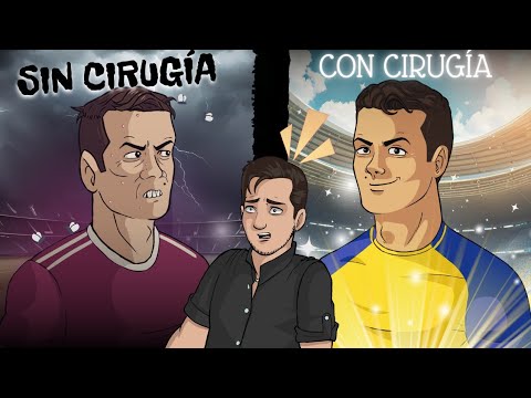 Antes y Después, ¡Todas las cirugías de los Futbolistas!