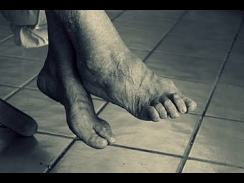 Los cuidados del pie geriátrico