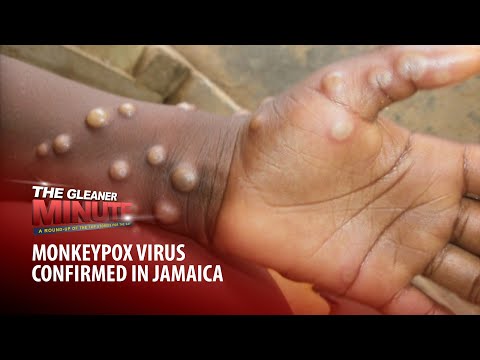 THE GLEANER MNIUTE: Monkeypox in Jamaica | Interpol notice for Popcaan | Sterling to go to Chelsea