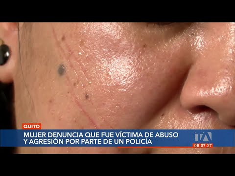 Mujer denuncia ser víctima de abuso y agresión por parte de un policía
