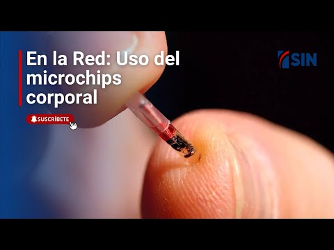 En la Red: El uso del microchips corporal