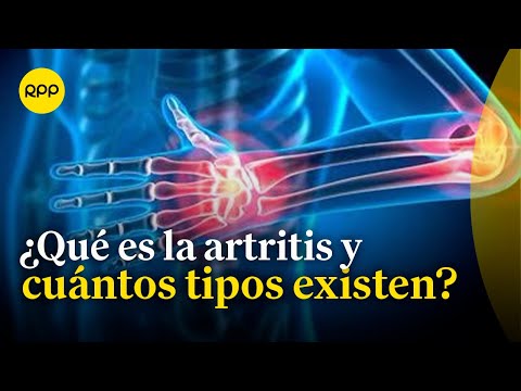 ¿Cuáles son las causas, síntomas y tipos de artritis?