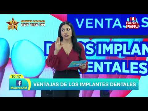 Mujeres al mando - Ventajas de los implantes dentales (9 de Julio)