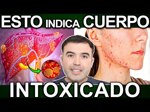 ¡PELIGRO ESTÁS INTOXICADO! Signos Y Síntomas Que Indican Toxinas En Tu Cuerpo