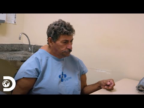 Un hombre padece la rara enfermedad de madelung  | Mi Cuerpo, Mi Desafío | Discovery Latinoamérica