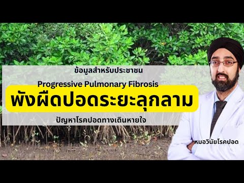 พังผืดปอดระยะลุกลาม|นพ.วินัยโ