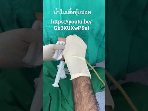 น้ำในเยื้อหุ้มปอด น้ำในเยื้อหุ้มปอด
