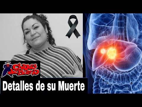 Detalles del fallecimiento de Susana Ortiz, ex vocalista de Chicos de Barrio