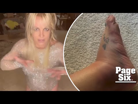 Britney Spears shows off bruised and swollen foot, blames mom Lynne for hotel drama