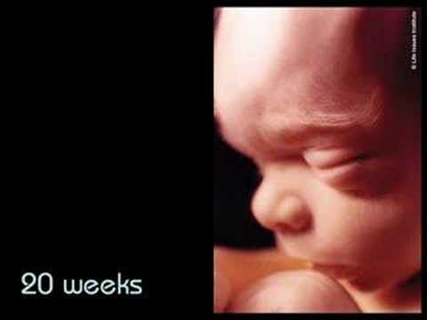 Video: Abortas, - Moterie, pagalvok ką darai..