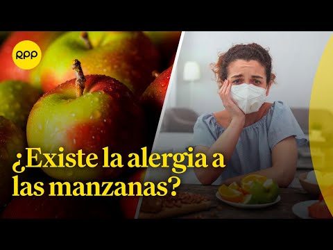 ¿Existe la alergia a las manzanas? | Espacio vital