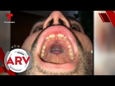 Un artista realiza insólitos tatuajes en el paladar de la boca | Al Rojo Vivo | Telemundo