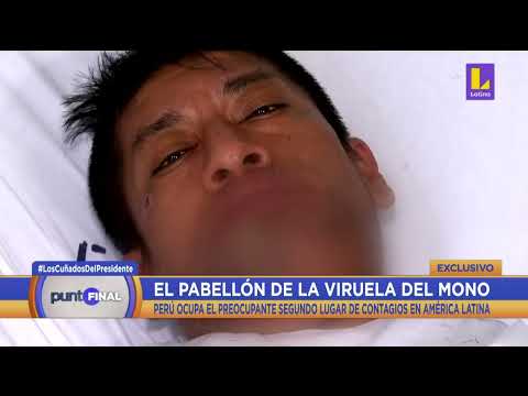 ?#PuntoFinal IMÁGENES EXCLUSIVAS del pabellón de infectados con la VIRUELA DEL MONO