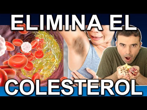 BAJA EL COLESTEROL ALTO EN 3 DIAS - Como Curar La Hipercolesterolemia O Elimina Grasa En La Sangre