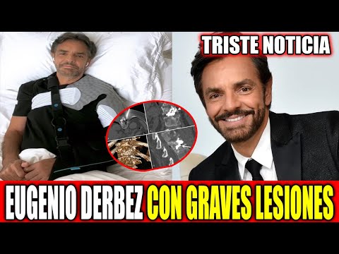 SUCEDIO HOY ! Hace unas Horas ! EUGENIO DERBEZ reapareció para contar que sufrió 15 fracturas