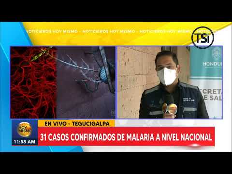 31 casos confirmados de malaria a nivel nacional