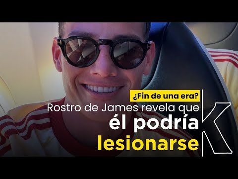 ¿Se va a lesionar?, esto dice el rostro de James Rodríguez sobre su futuro