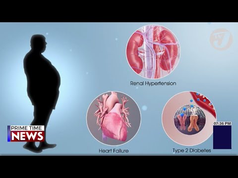 Metabolic Syndrome is becoming Increasingly Common | TVJ News