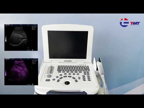 UltrasoundDaweiDW-330