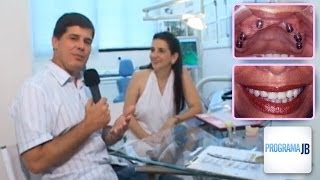 Programa JB Sobre Implantes