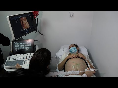 Minsa entrega ultrasonidos de alta tecnología a hospitales de Nicaragua