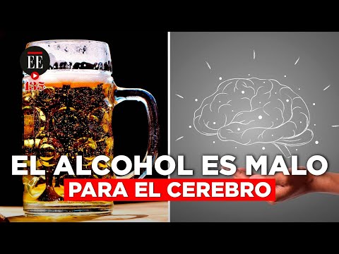 El consumo moderado de alcohol también afecta al cerebro | El Espectador