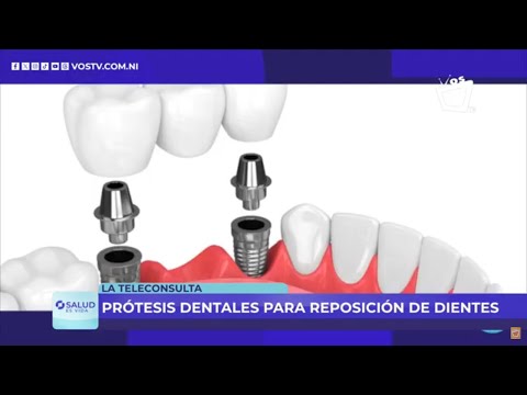 ¿Qué tipo de prótesis dental es más recomendable para vos?