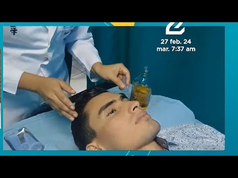 Terapia de ventosa para el tratamiento de la parálisis facial