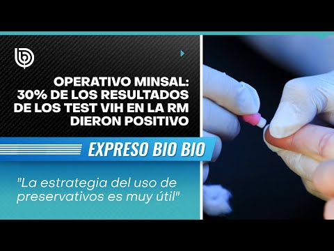 Operativo Minsal: 30% de los resultados de los test VIH en la R. Metropolitana dieron positivo