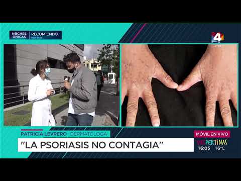 Vespertinas - La psoriasis no contagia