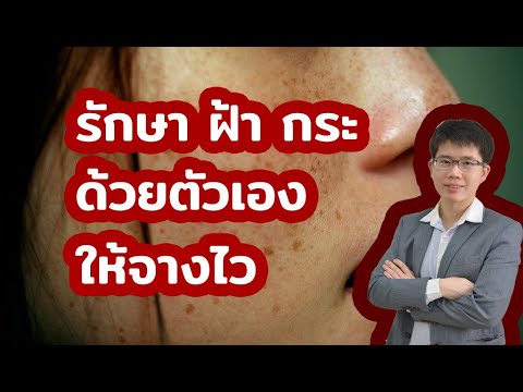 รักษาฝ้ากระ-ทางเลือกใหม่-ทำได้ รักษาฝ้ากระ-ทางเลือกใหม่-ทำได้