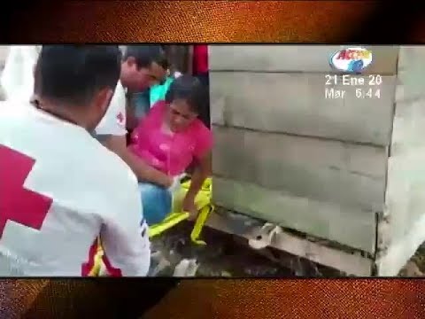 Mujer fue rescatada luego de caer a un pozo en Bluefields